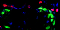 SatelliteCells&Fibroblasts